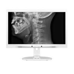 Монитор Philips C240P4QPYEW Монитор Philips C240P4QPYEW